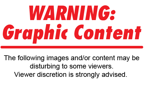 warning-graphic-content